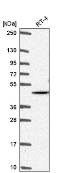 Anti-AKT2 Antibody