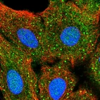 Immunofluorescent staining of human cell line A549 shows localization to nucleus, cytosol & vesicles.
