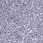 Anti-SLC30A10 Antibody