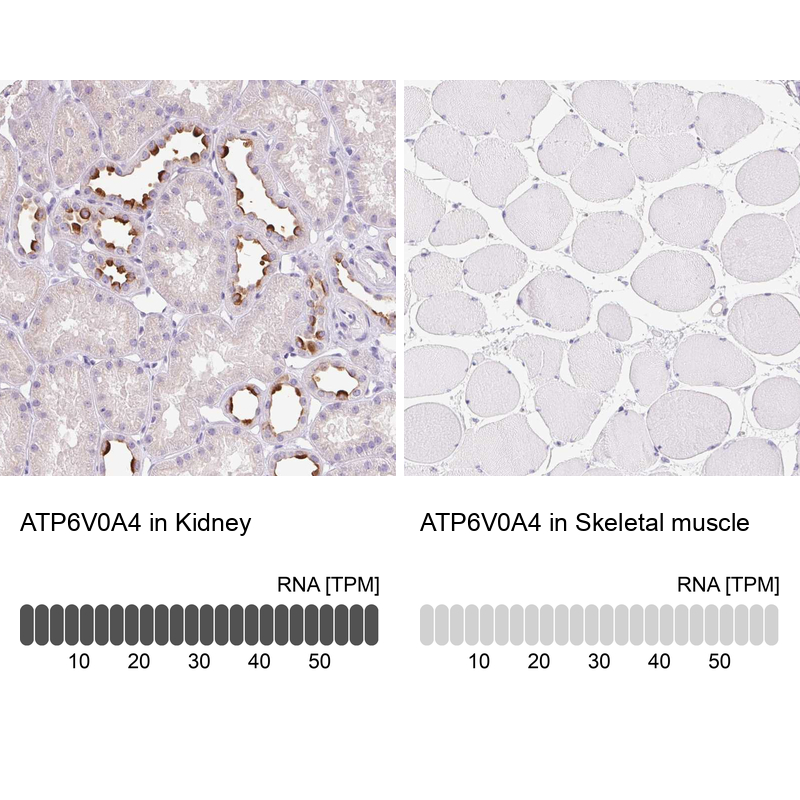 Anti-ATP6V0A4 Antibody