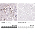 Anti-ATP6V0A4 Antibody