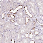 Immunohistochemical staining of human kidney shows strong membranous positivity in cells in tubules.