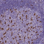 Immunohistochemical staining of human tonsil shows strong cytoplasmic positivity in lymphoid cells.