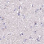 Anti-ATP6V0A4 Antibody
