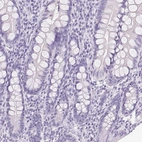 Immunohistochemical staining of human small intestine shows no positivity in glandular cells as expected.