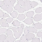 Immunohistochemical staining of human skeletal muscle shows no positivity in myocytes as expected.