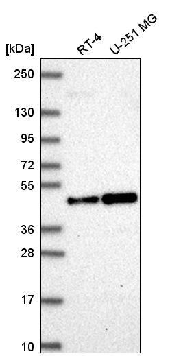 Anti-ORC4 Antibody