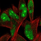 Immunofluorescent staining of human cell line RH-30 shows localization to nucleus & nucleoli.