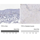 Anti-TYR Antibody