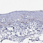 Immunohistochemical staining of human skin shows high expression.