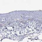 Immunohistochemical staining of human skin shows high expression.