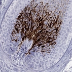 Immunohistochemical staining of human hair shows strong cytoplasmic positivity in medulla.