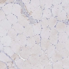 Immunohistochemical staining of human skeletal muscle shows low expression as expected.