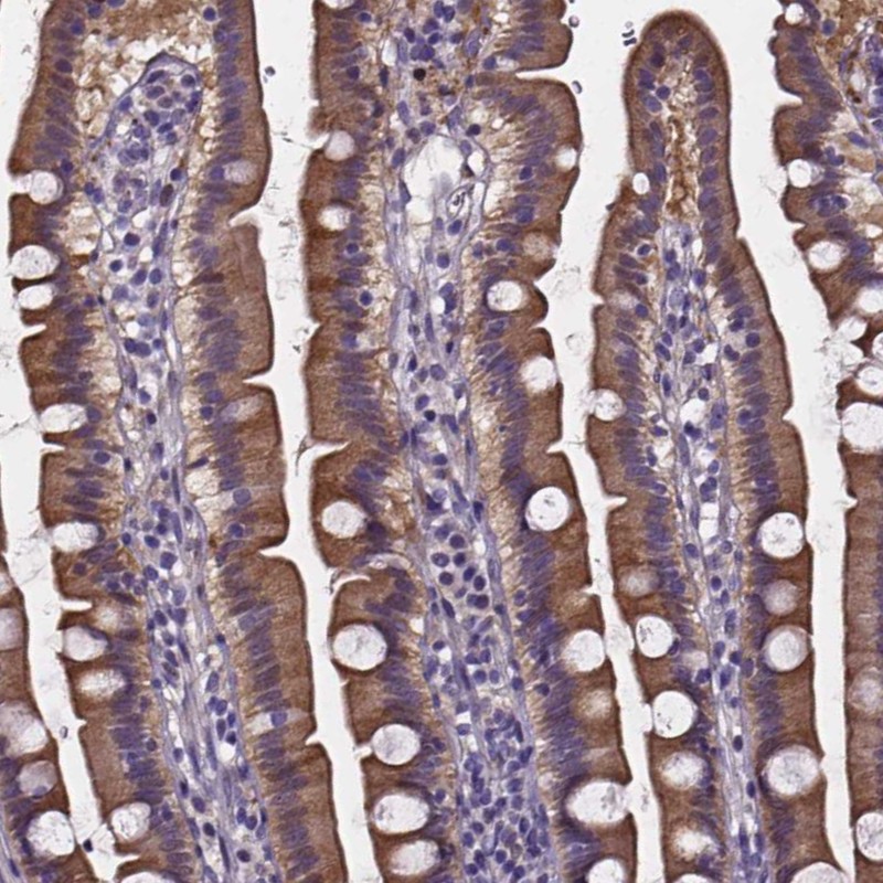 Anti-SOWAHA Antibody