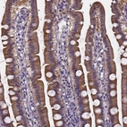 Anti-SOWAHA Antibody
