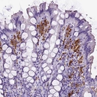 Immunohistochemical staining of human colon shows strong cytoplasmic positivity in lymphoid cells.