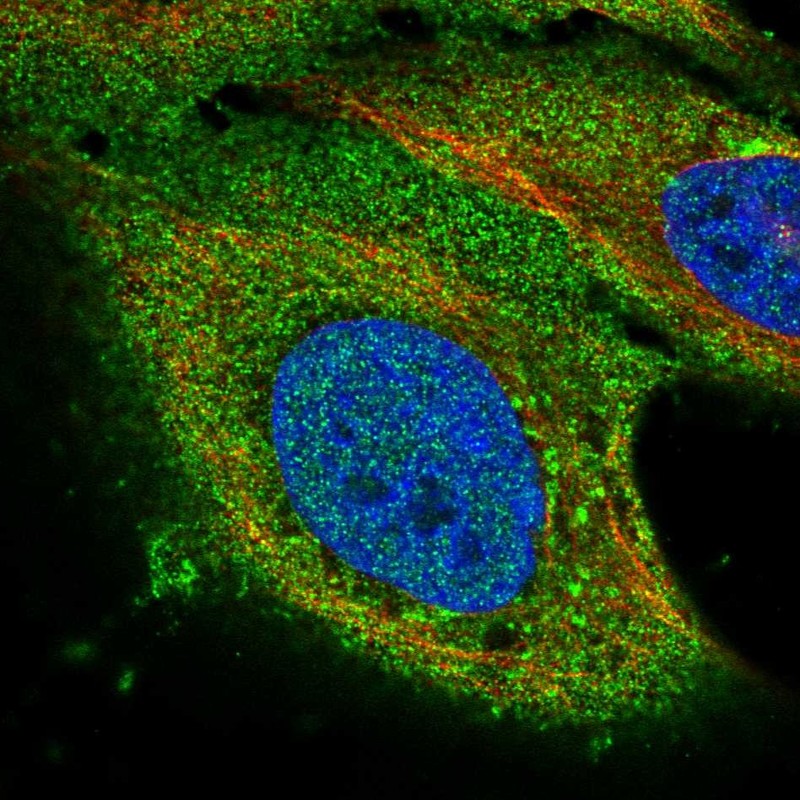 Anti-PAQR8 Antibody