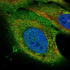 Anti-PAQR8 Antibody