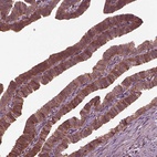 Anti-GTPBP1 Antibody