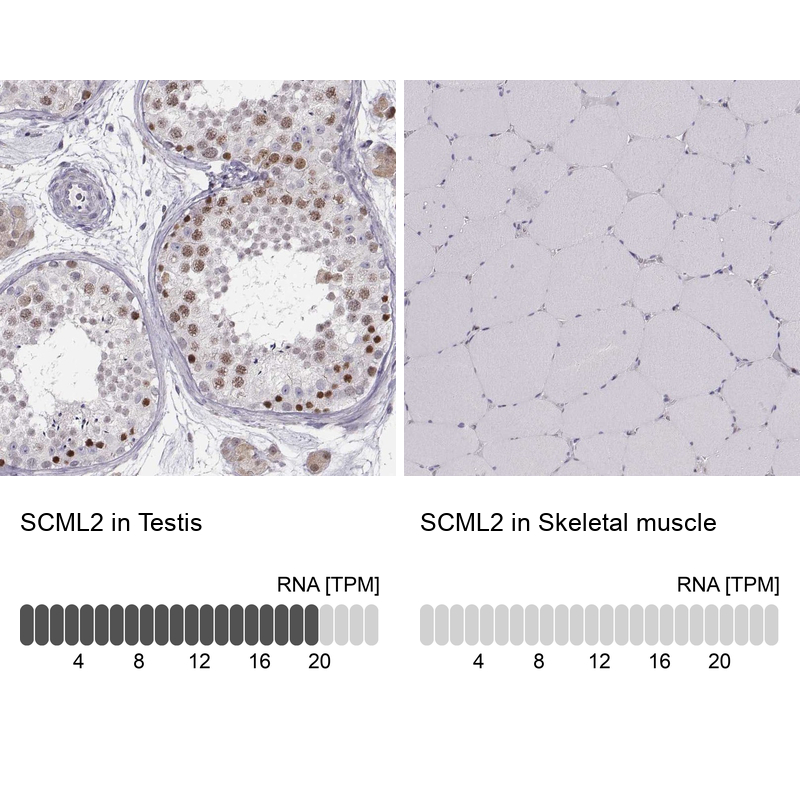 Anti-SCML2 Antibody