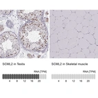 Anti-SCML2 Antibody