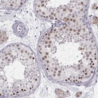 Immunohistochemical staining of human testis shows high expression.