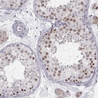 Immunohistochemical staining of human testis shows high expression.