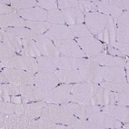 Immunohistochemical staining of human skeletal muscle shows no positivity in myocytes as expected.