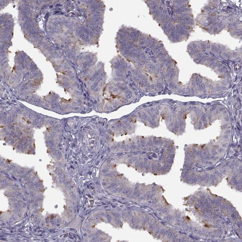 Anti-C9orf116 Antibody
