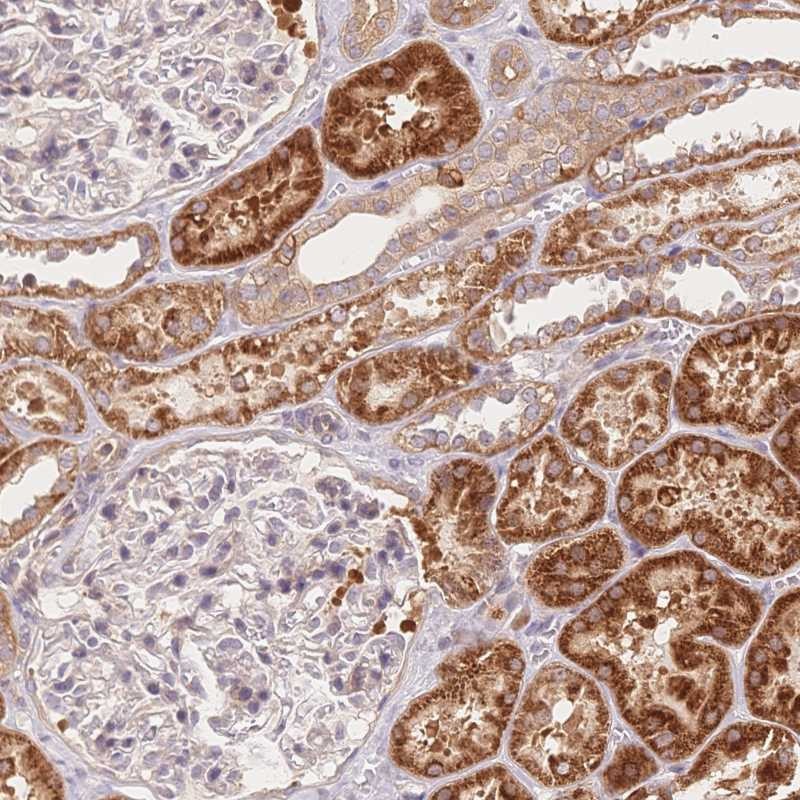 Anti-C12orf75 Antibody