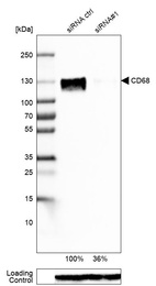 Western blot analysis in U-87MG ATCC cells transfected with control siRNA, target specific siRNA probe #1, using Anti-CD68 antibody. Remaining relative intensity is presented. Loading control: Anti-GAPDH.
