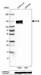 Western blot analysis in U-87MG ATCC cells transfected with control siRNA, target specific siRNA probe #1, using Anti-CD68 antibody. Remaining relative intensity is presented. Loading control: Anti-GAPDH.