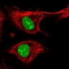 Anti-ZFP91 Antibody