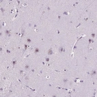Anti-C18orf21 Antibody