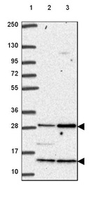 Lane 1: Marker [kDa] 250, 130, 95, 72, 55, 36, 28, 17, 10_br/_Lane 2: Human cell line RT-4_br/_Lane 3: Human cell line U-251 MG