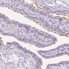 Immunohistochemical staining of human fallopian tube shows high expression.
