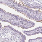Immunohistochemical staining of human fallopian tube shows high expression.