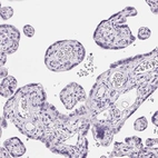 Immunohistochemical staining of human placenta shows low expression as expected.