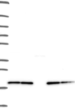 Anti-NDUFB8 Antibody