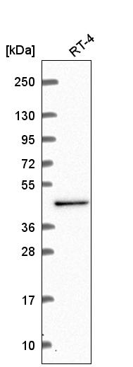 Anti-CWC27 Antibody