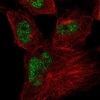 Immunofluorescent staining of human cell line U-251 MG shows localization to nucleoplasm.