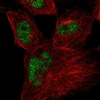 Immunofluorescent staining of human cell line U-251 MG shows localization to nucleoplasm.