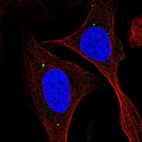 Immunofluorescent staining of human cell line U-2 OS shows localization to vesicles.
