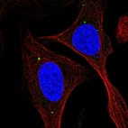 Immunofluorescent staining of human cell line U-2 OS shows localization to vesicles.