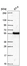 Anti-POLM Antibody