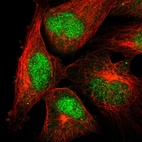 Immunofluorescent staining of human cell line U-251 MG shows localization to nucleus & cytosol.