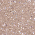 Immunohistochemical staining of human cerebral cortex shows weak positivity in neuropil.