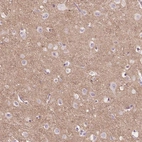 Immunohistochemical staining of human cerebral cortex shows weak positivity in neuropil.
