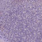 Immunohistochemical staining of human tonsil shows no positivity in non-germinal center cells as expected.