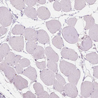 Immunohistochemical staining of human skeletal muscle shows no positivity in myocytes as expected.